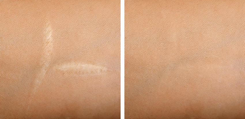 Jak malować twarz z bliznami?