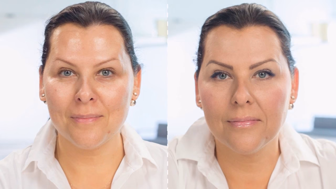 Jaki zabieg likwiduje chomiki na twarzy?