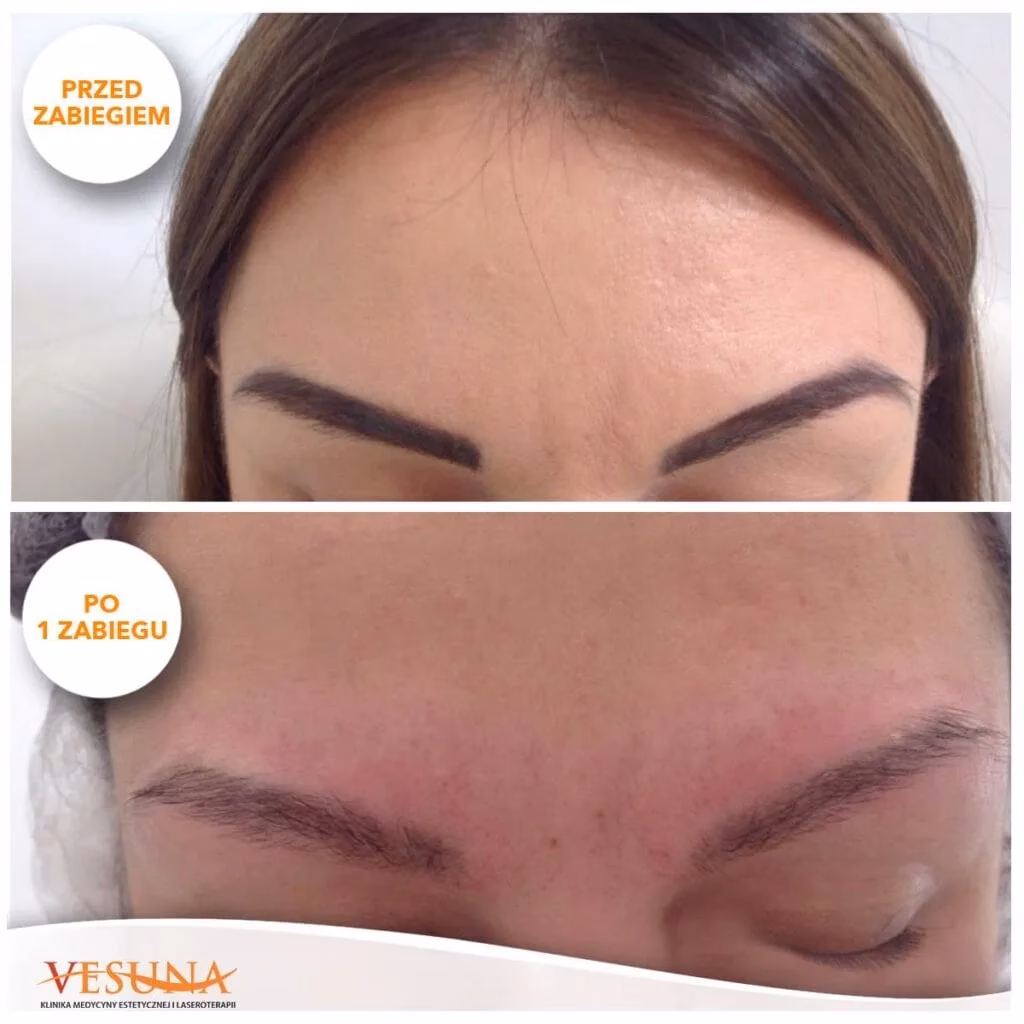 Czy można iść na makijaż z opryszczka?