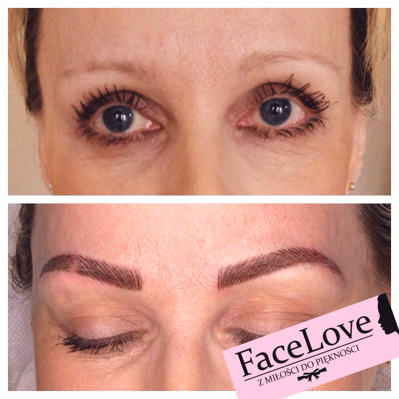 A co jeśli masz pieprzyk w brwi?