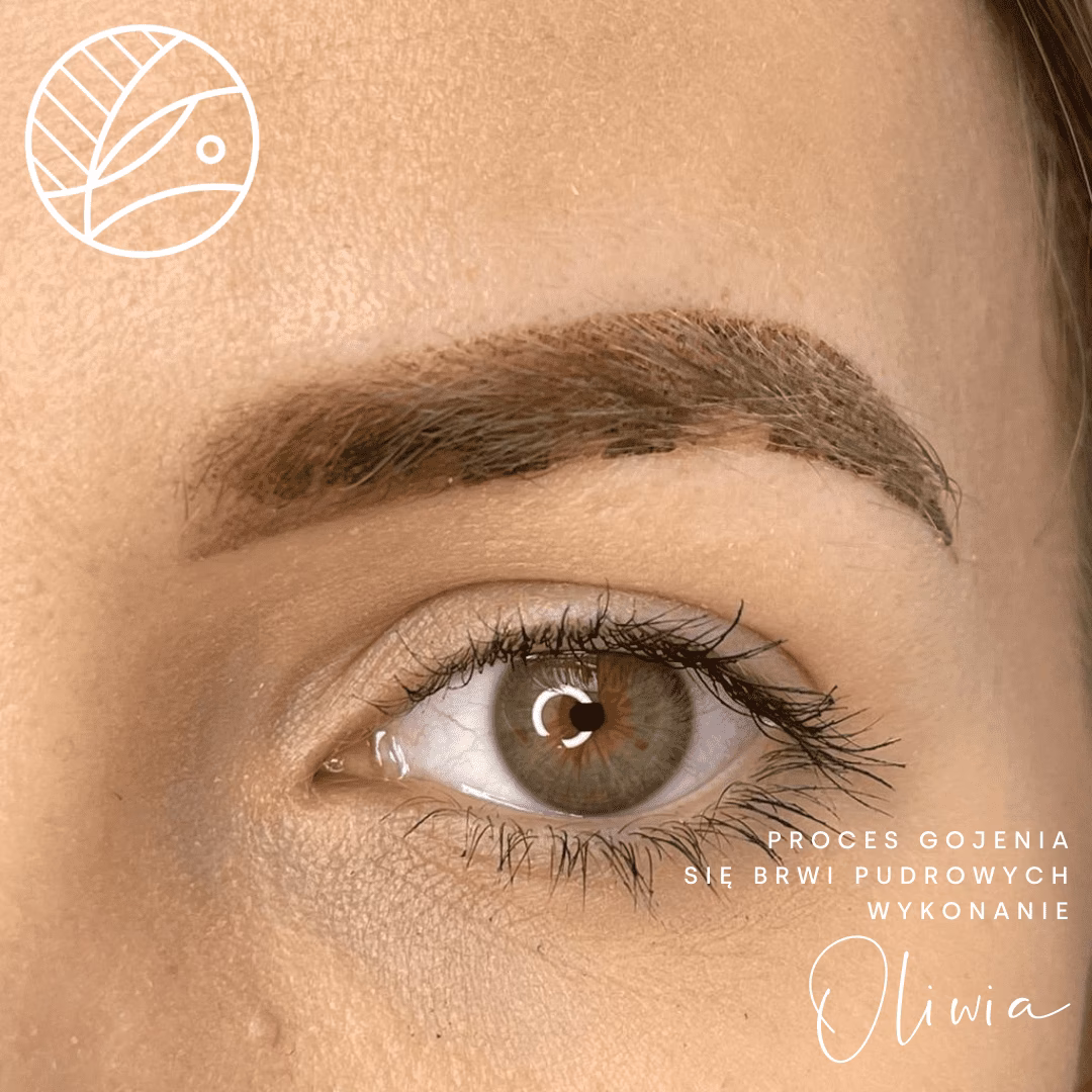 Jak długo trwa odpadanie strupów na brwiach?