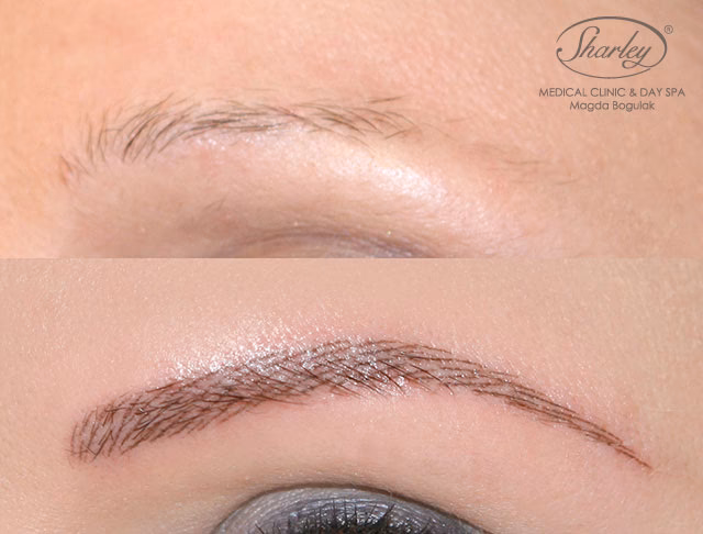 Na czym polega metoda kreskowa brwi?