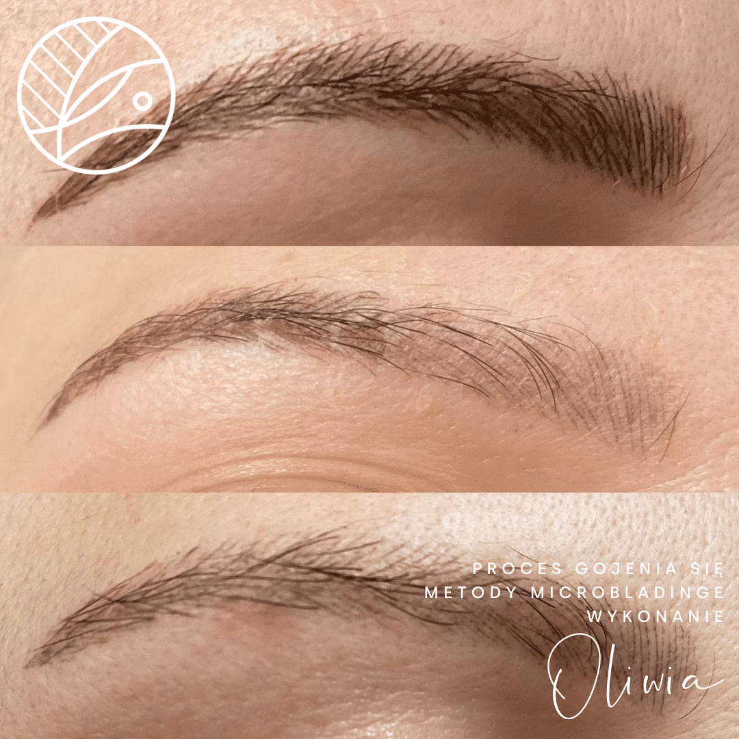 Co robić, gdy brwi ombre swędzą?