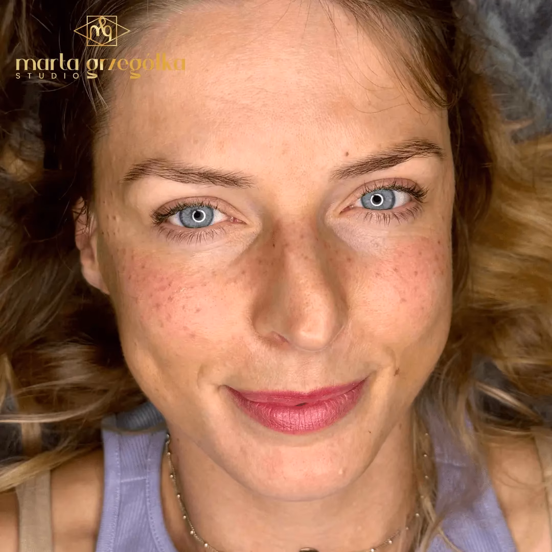 Jak długo utrzymuje się pigmentacja piegów?