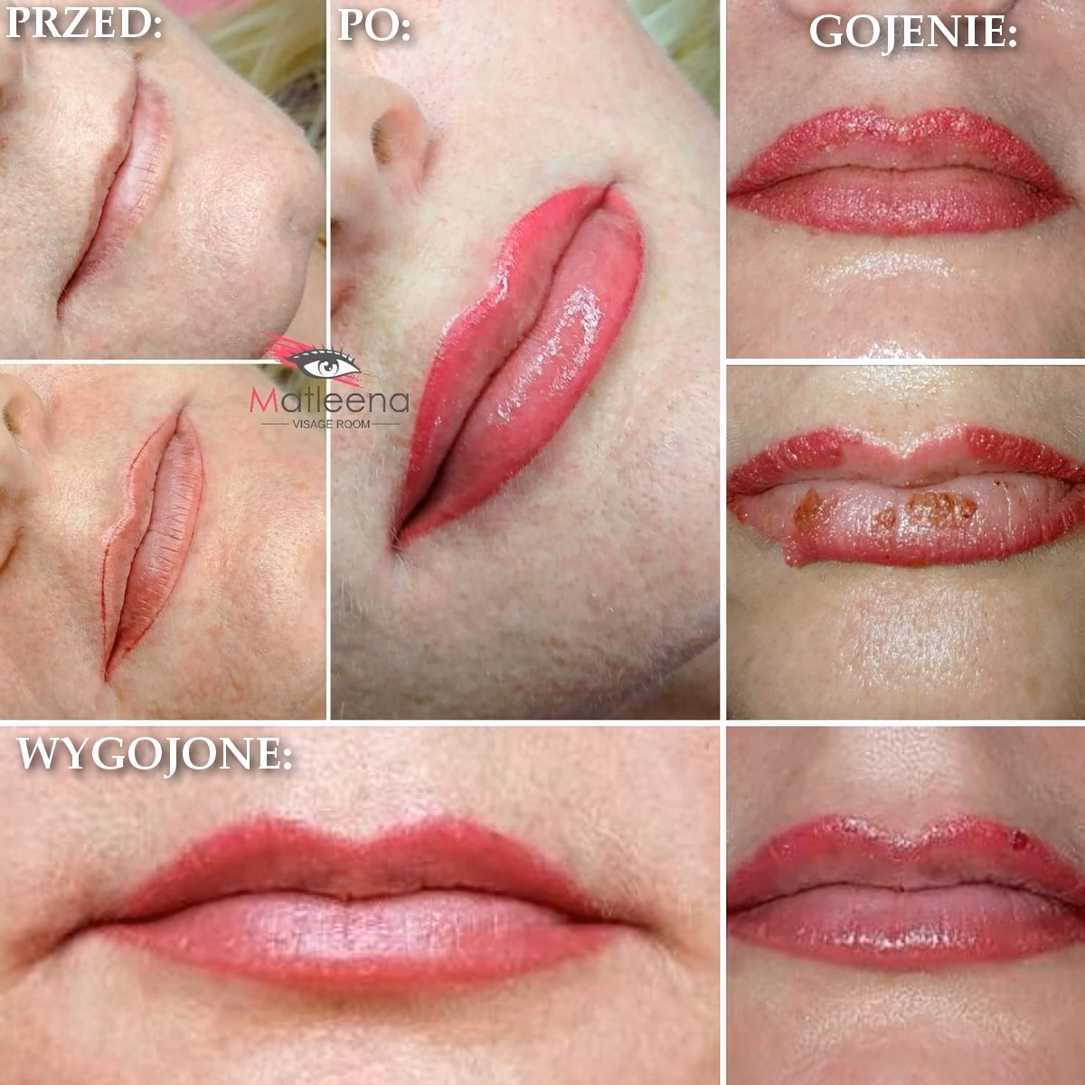 Czy należy smarować usta po makijażu permanentnym?