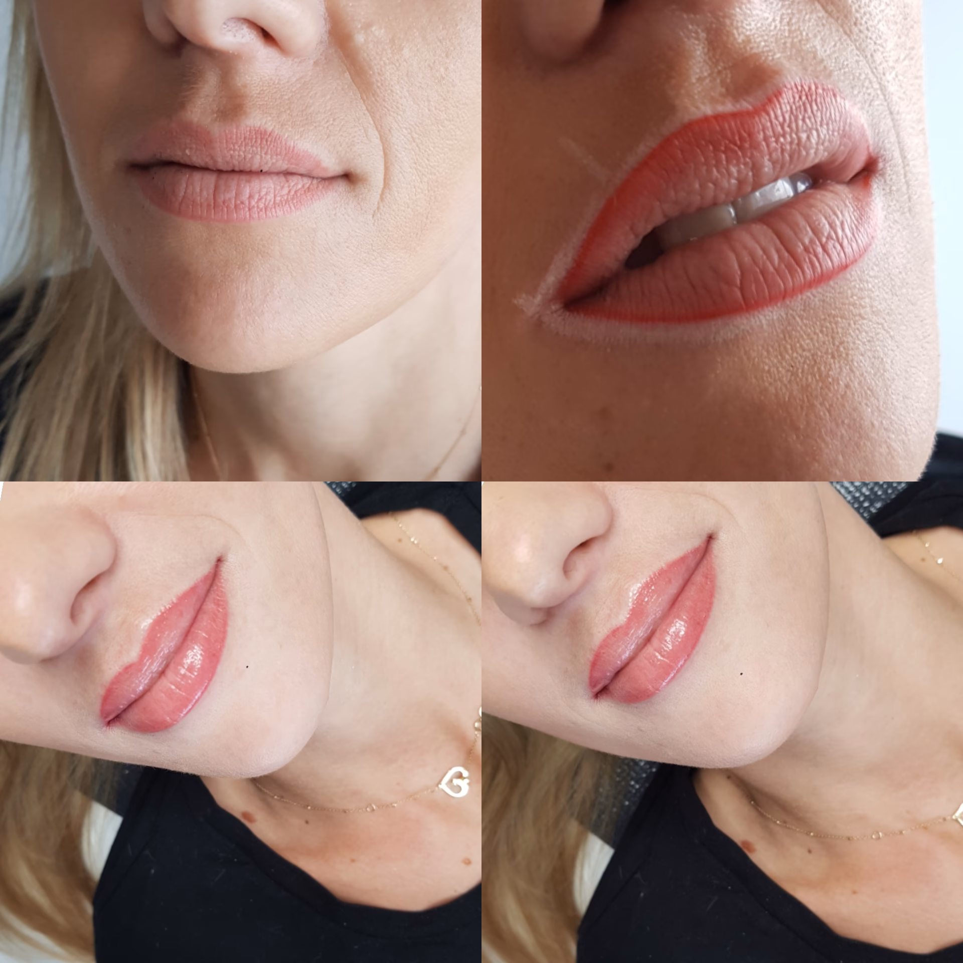 Jak wyglądają usta po pigmentacji?