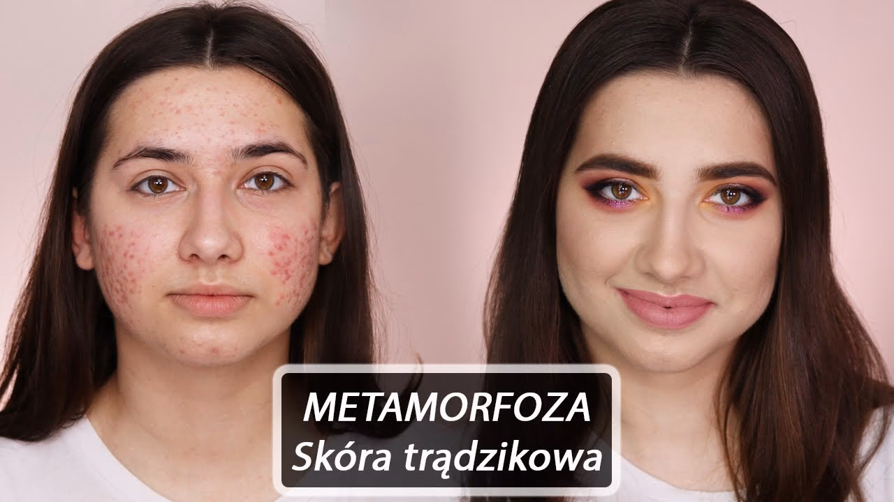 Jak pozbyć się niedoskonałości za pomocą makijażu?