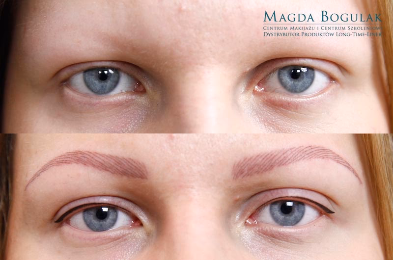 Czym jest makijaż permanentny medyczny?