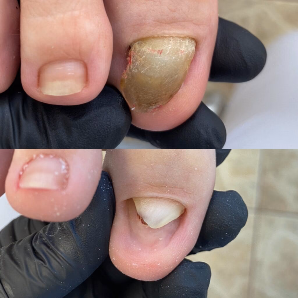 Jaka powinna być grubość paznokcia?