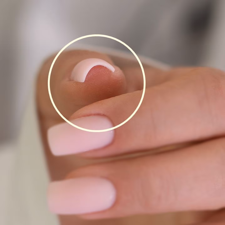 Jak pozbyć się paznokci w kształcie litery C?