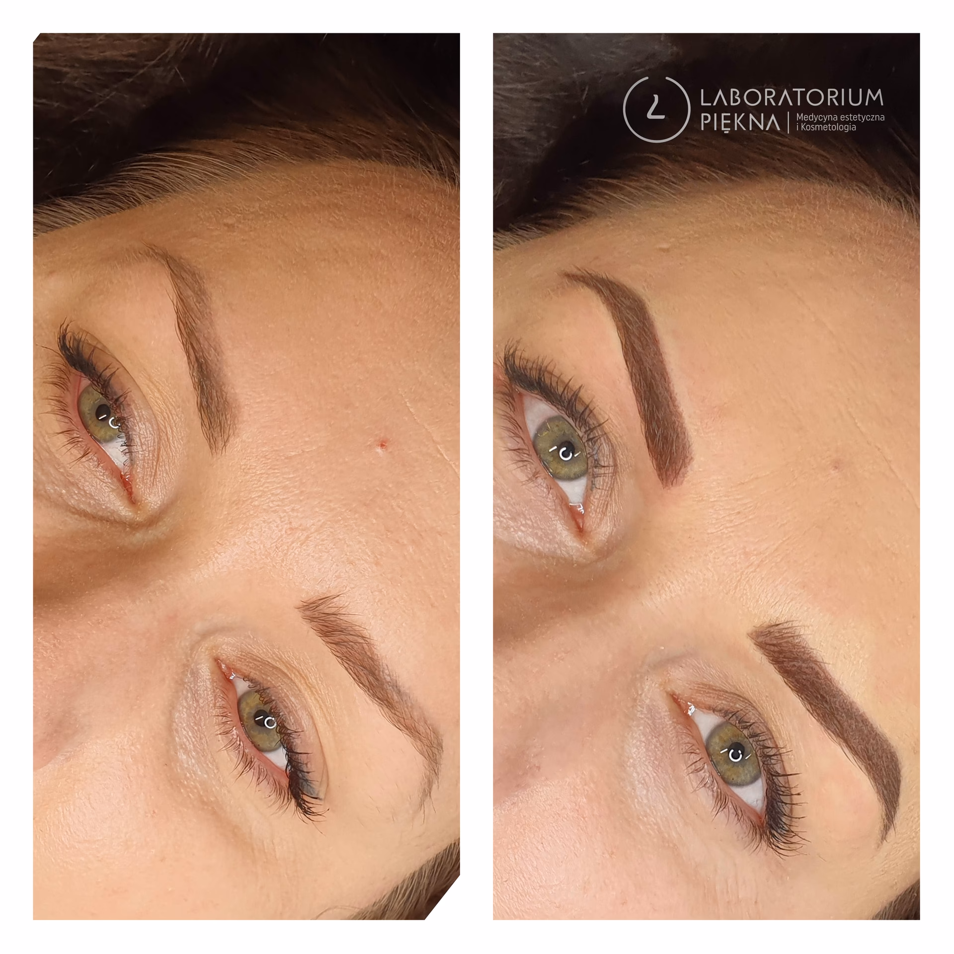 Czy można wykonać microblading na sterydach?