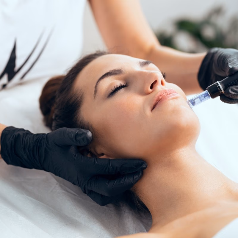 Ile kosztuje zabieg z dermapenem?